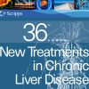 Scripps 36th Annual New Treatments in Chronic Liver Disease 2022 (CME VIDEOS)