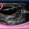 Pegasus Breast Ultrasound video course 2022