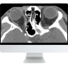 ARRS Imaging Victims of Violence: Fists, Stabs, Bullets, and Blasts 2021 (CME VIDEOS)