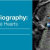2018 Fetal Echocardiography: Normal and Abnormal Hearts (CME Videos)