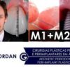 Aesthetic Periodontal and Peri-Implant Plastic Surgeries Portugase with English
