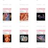 Ultrasound in Obstetrics & Gynecology 2024 Full Archives (True PDF)