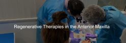 VISTA Institute for Therapeutic Innovations Regenerative Therapies in the Anterior Maxilla 2021