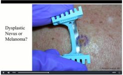 Continuing Education Company Primary Care On Demand Dermatology Volume 2 2020