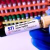 Continuing Education Company Sexually Transmitted Infections An Update on the Recognition and Management of Common STI Syndromes 2023
