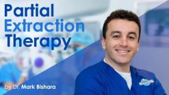 Partial Extraction Therapy