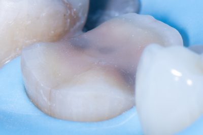 The Baard Institute Overlay, Onlay, & Advanced Adhesion