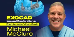 OHI-S EXOCAD Implant Restorations – Step-by-step Video Guide 2023