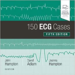 150 ECG Cases 5th Edition