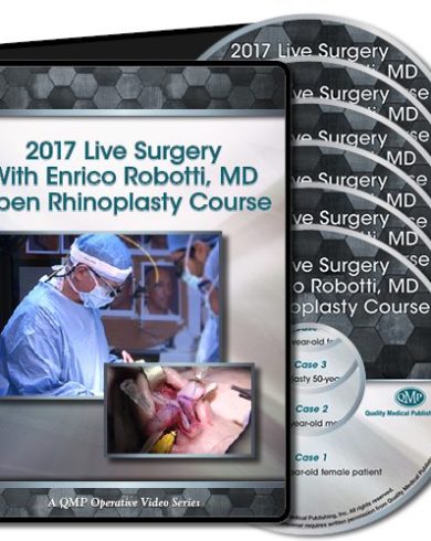 2017 Live Surgery With Enrico Robotti Open Rhinoplasty Course