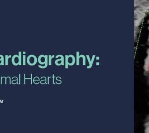 2021 Fetal Echocardiography: Normal and Abnormal Hearts (CME VIDEOS)