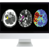 ARRS Code Stroke: What Every Radiologist Should Know 2022