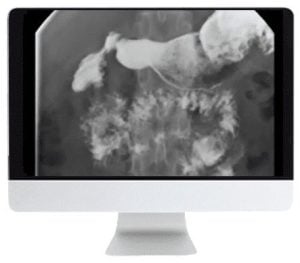 ARRS Practical Pediatric Imaging 2021 (CME VIDEOS)