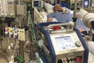 Adult ECLS Course – Innovative ECMO Concepts