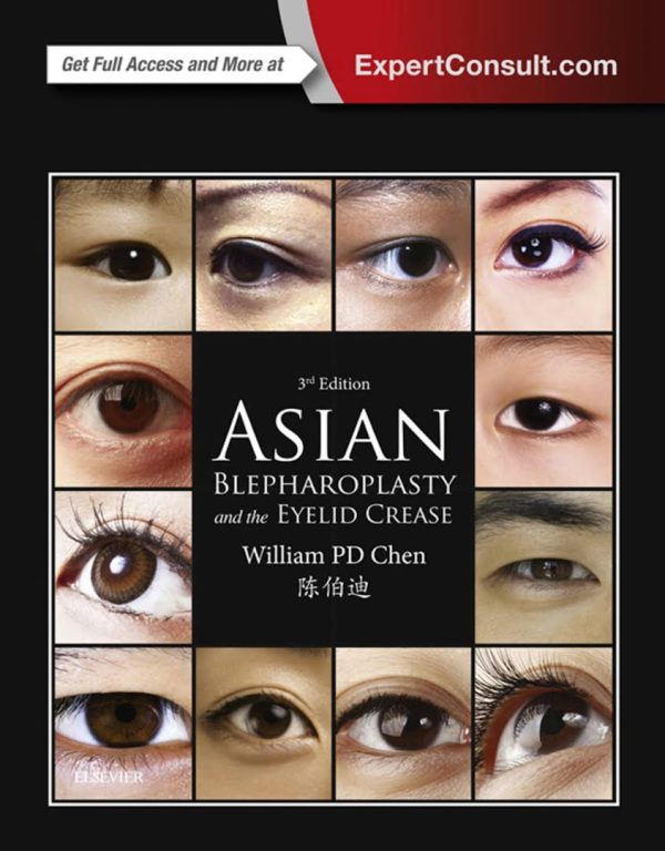 Asian Blepharoplasty and the Eyelid Crease 3rd Edition (PDF+Videos)