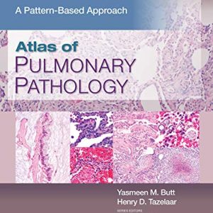 Atlas of Pulmonary Pathology: A Pattern Based Approach (azw3+epub+Converted PDF)