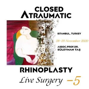 Closed Atraumatic Rhinoplasty Live Surgery DVD 5