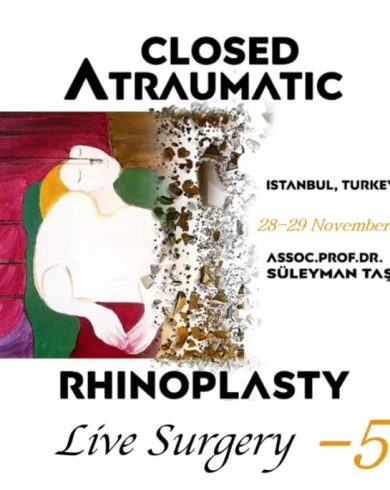 Closed Atraumatic Rhinoplasty Live Surgery DVD 5