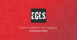 ECHO-Guided Life Support Using ultrasound to categorise shock and guide initial management (CME VIDEOS)