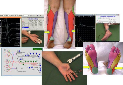 EMG/NCS Online Series: Volume III Sensory Nerve Conduction Studies (2nd Edition) (Videos)