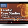 Gulfcoast Carotid Case Studies (Videos+PDFs)