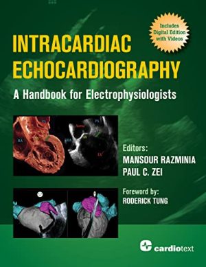 Intracardiac Echocardiography: A Handbook for Electrophysiologists (Original PDF from Publisher)