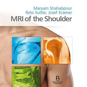 MRI of the Shoulder (Original PDF from Publisher)