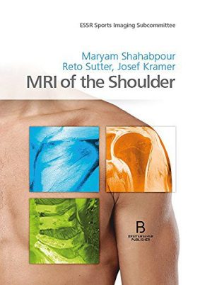 MRI of the Shoulder (Original PDF from Publisher)