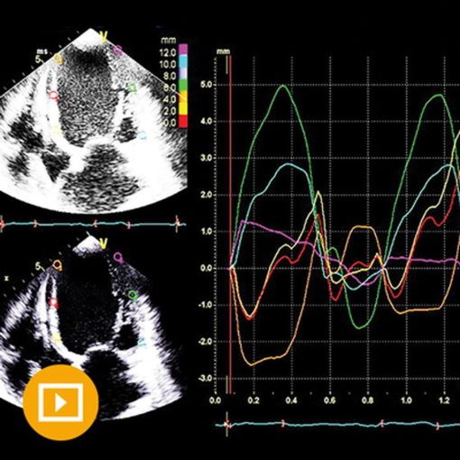 Oakstone Echocardiography A Comprehensive Review 2022