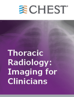 Thoracic Radiology: Imaging for Clinicians (Chestnet) 2021 (Videos + Quiz)