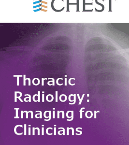 Thoracic Radiology: Imaging for Clinicians (Chestnet) 2021 (Videos + Quiz)