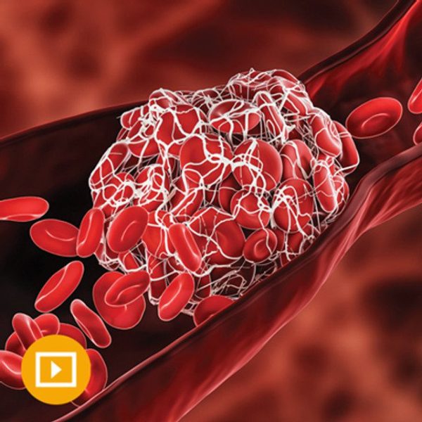 Thrombosis & Thromboembolism 2022 (CME VIDEOS)