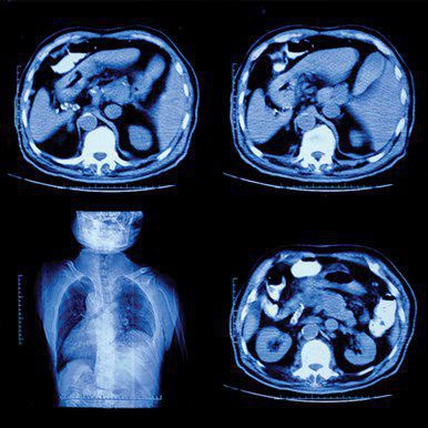 UCSF Abdominal and Thoracic Imaging 2022 ( VIDEOS)