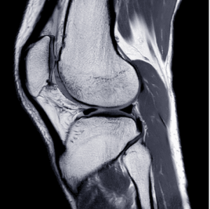 UCSF Neuro and Musculoskeletal Imaging 2022