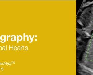 2019 Fetal Echocardiography: Normal and Abnormal Hearts (CME Videos)