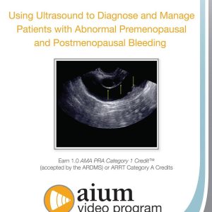 AIUM Using Ultrasound to Diagnose and Manage Patients with Abnormal Premenopausal and Postmenopausal Bleeding