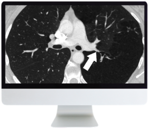 ARRS Basic Chest Imaging 2019