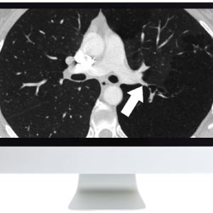 ARRS Basic Chest Imaging 2019