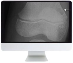 ARRS Clinical Case-Based Review of Musculoskeletal Imaging 2019