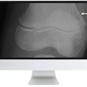 ARRS Clinical Case-Based Review of Musculoskeletal Imaging 2019