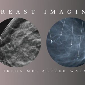 CME Science Breast Imaging BUNDLE (Programs 1-3) Debra Ikeda MD, Alfred Watson MD 2020