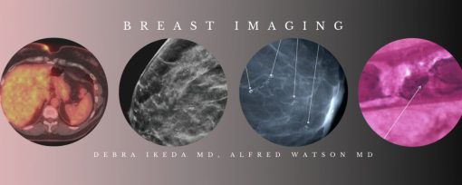 CME Science Breast Imaging BUNDLE (Programs 1-3) Debra Ikeda MD, Alfred Watson MD 2020