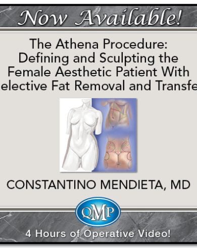 The Athena Procedure: Defining and Sculpting the Female Aesthetic Patient With Selective Fat Removal and Transfer 2024