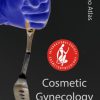 ISCG Video Atlas of Cosmetic Gynecology