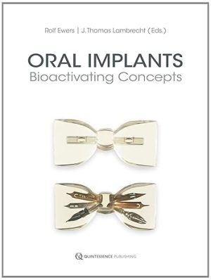 Oral Implants: Bioactivating Concepts (Scanned PDF)