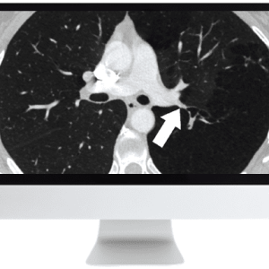 ARRS Basic Chest Imaging 2019 (CME VIDEOS)