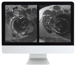 ARRS Controversies in Hip and Pelvis Imaging 2016 (CME VIDEOS)