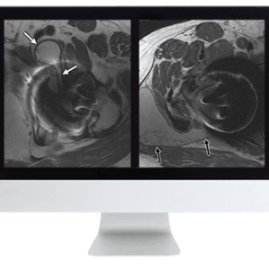 ARRS Controversies in Hip and Pelvis Imaging 2016 (CME VIDEOS)