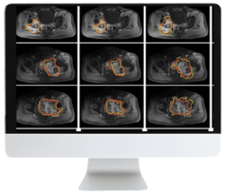 ARRS Crossroads of Computational Science and Musculoskeletal Imaging: Where Machine Magic Can Aid Radiologists 2021 (CME VIDEOS)