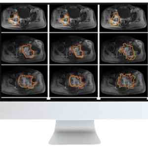 ARRS Crossroads of Computational Science and Musculoskeletal Imaging: Where Machine Magic Can Aid Radiologists 2021 (CME VIDEOS)